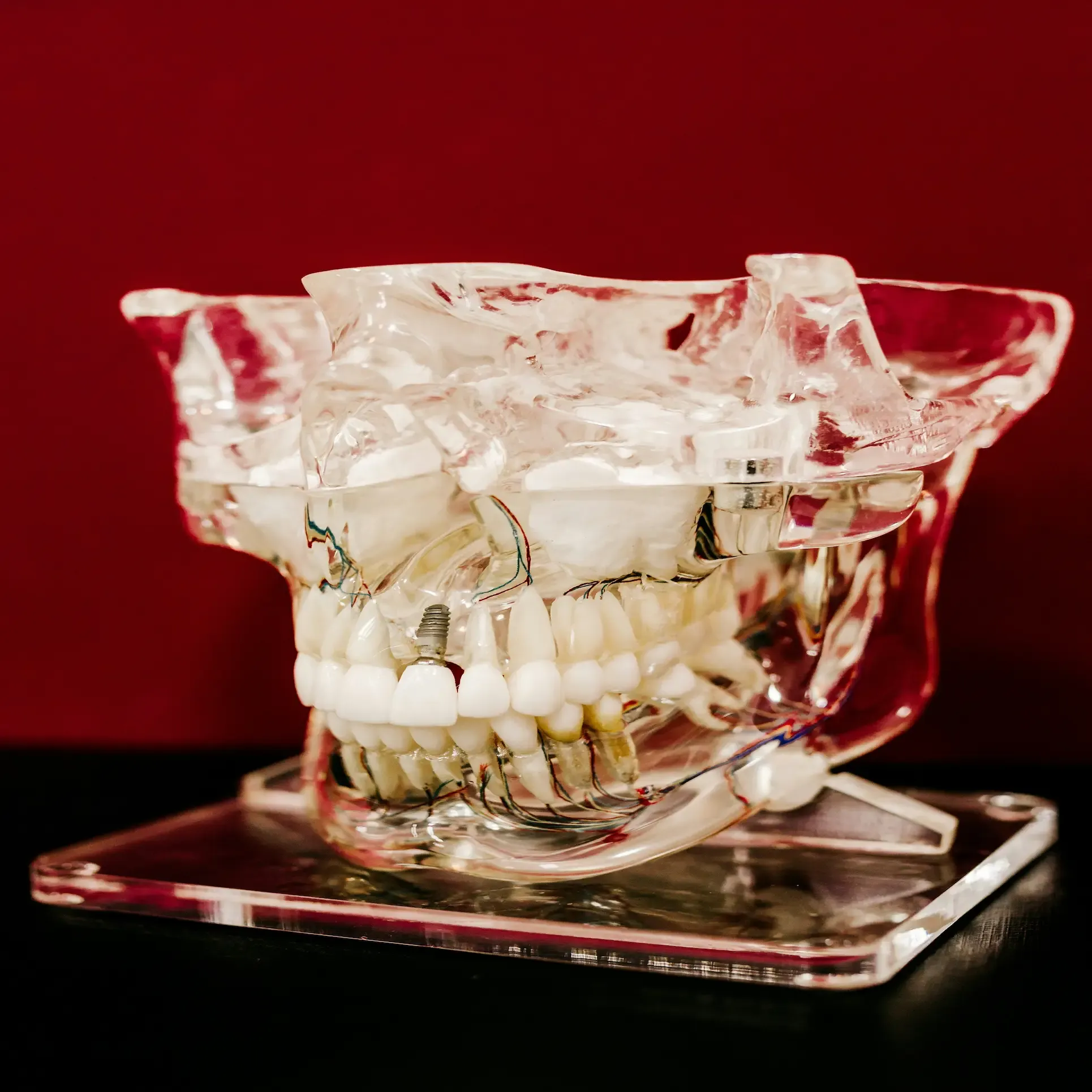 Articulación Temporomandibular