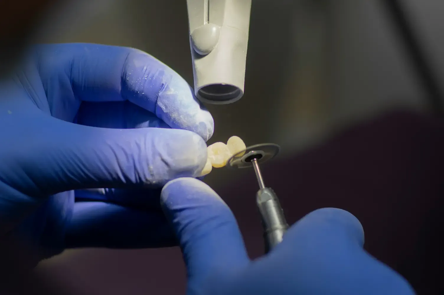 Prótesis Dentales